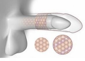 Povečan penis v prostornini