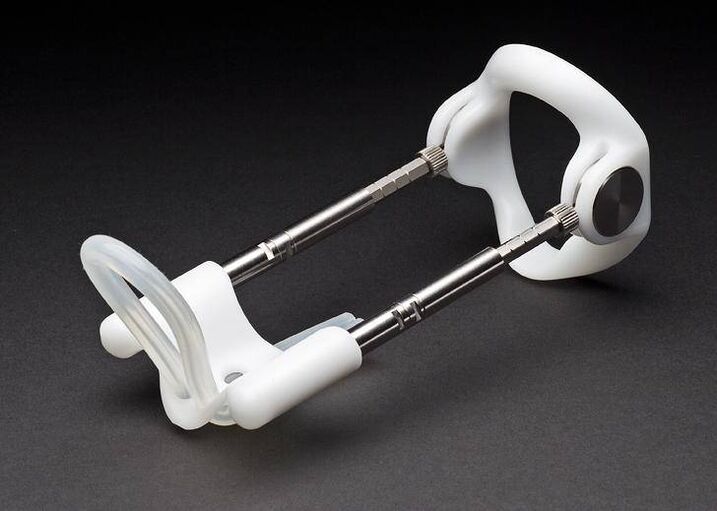 podaljšek po operaciji povečanja penisa